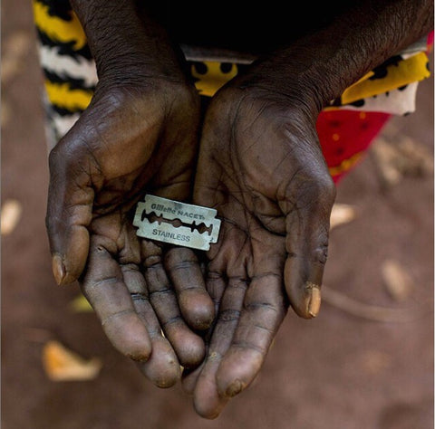 FGM